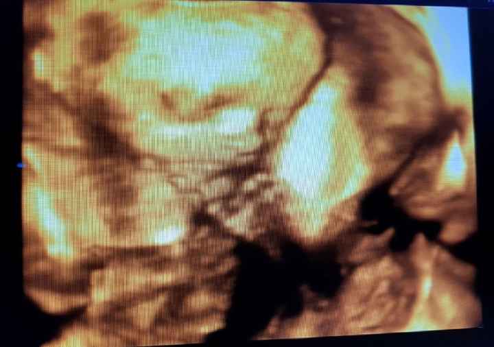 Futuras mamis junio 2018 - 2