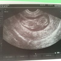 Eco 12 semanas