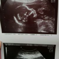 Mamis julio 2017 - 1