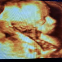 Futuras mamis junio 2018 - 1