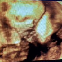 Futuras mamis junio 2018 - 2