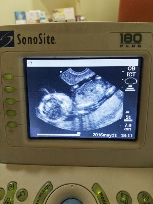 ¡futuras mamis noviembre 2016! - 1