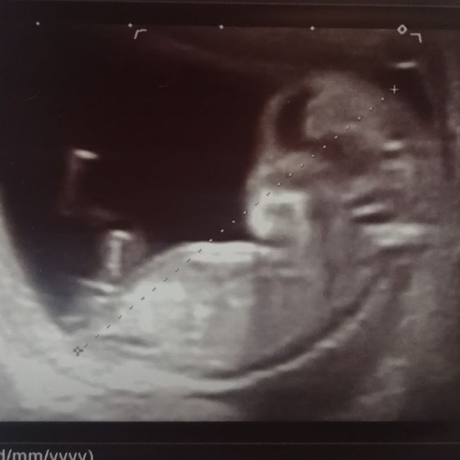 Futuras mamás julio 2021🤰🌹😍😍 2