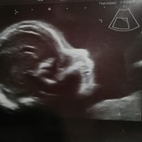 Futuras mamás julio 2021🤰🌹😍😍 - 1