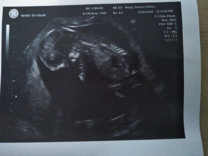 Futuras mamas octubre 2020 - 1