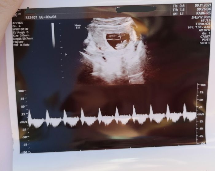 Futuras mamis Junio 2022!! 2