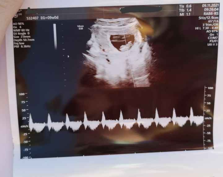 Futuras mamis Junio 2022!! - 1
