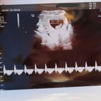 Futuras mamis Junio 2022!! - 1