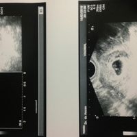 ¡futuras mamis noviembre 2016! - 1