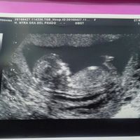 ¡futuras mamis noviembre 2016! - 1