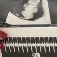 Futuras mamás agosto 2019 - 1