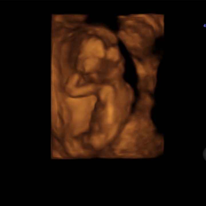 Futuras mamás septiembre 2019 - 1