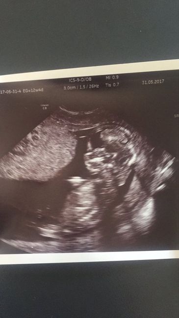 Buscadoras después de uno o varios abortos ii - 1