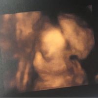 Futuras mamis diciembre 2017 - 1