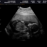 Futuras Mamas Julio 2020. - 1