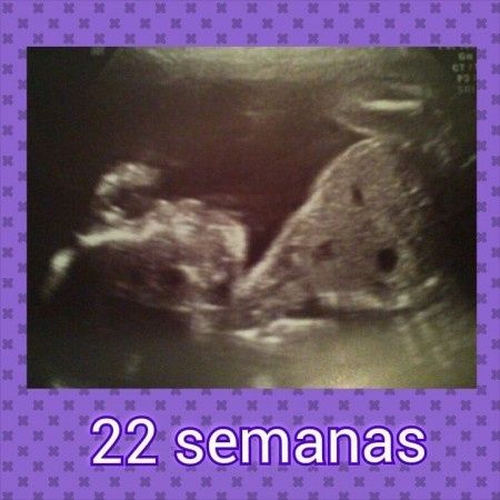 22 semanas