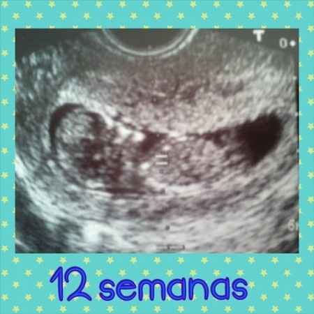 eco 12 semanas