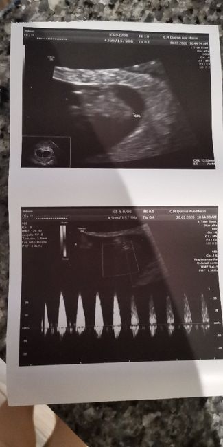 Futuras mamas noviembre 2020 - 1