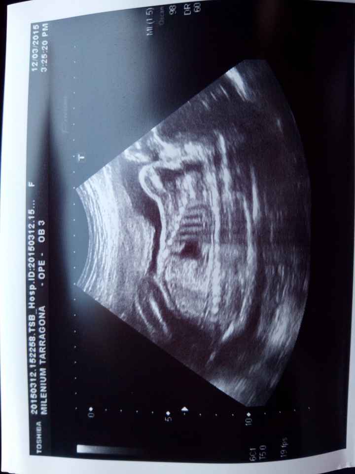Super mamás julio 2015!! :) - 2