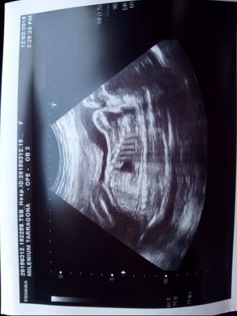 Super mamás julio 2015!! :) - 2