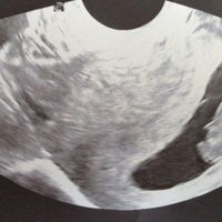  Futuras mamás agosto 2018 - 1