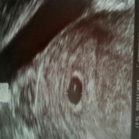 Futuras mamás enero 2017 - 1