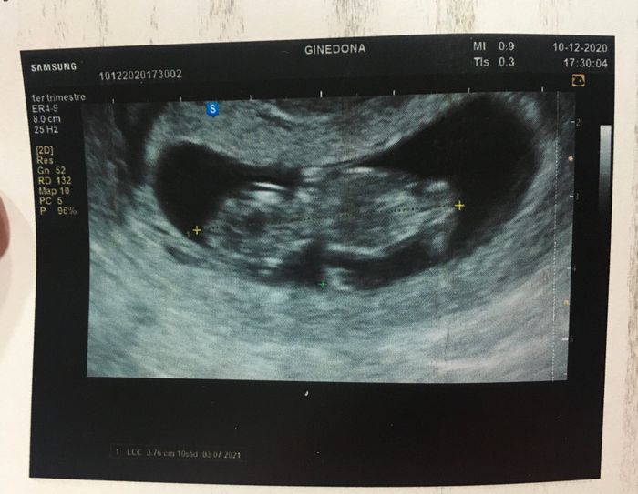 Futuras mamás julio 2021🤰🌹😍😍 2