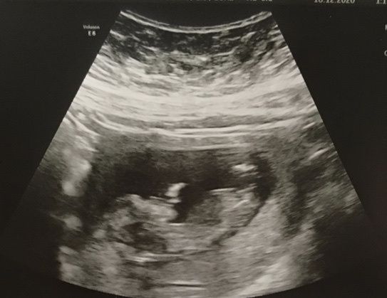 Futuras mamás julio 2021🤰🌹😍😍 3