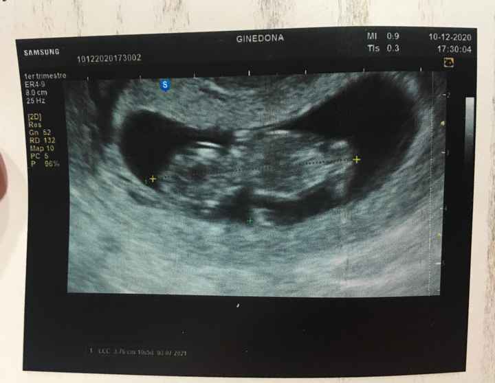 Futuras mamás julio 2021🤰🌹😍😍 - 1