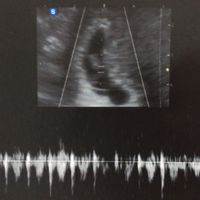 Futuras mamás julio 2021🤰🌹😍😍 - 1