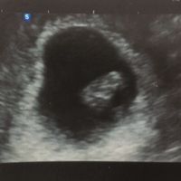 Futuras mamás julio 2021🤰🌹😍😍 - 2