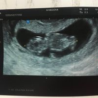 Futuras mamás julio 2021🤰🌹😍😍 - 1