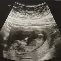 Futuras mamás julio 2021🤰🌹😍😍 - 2