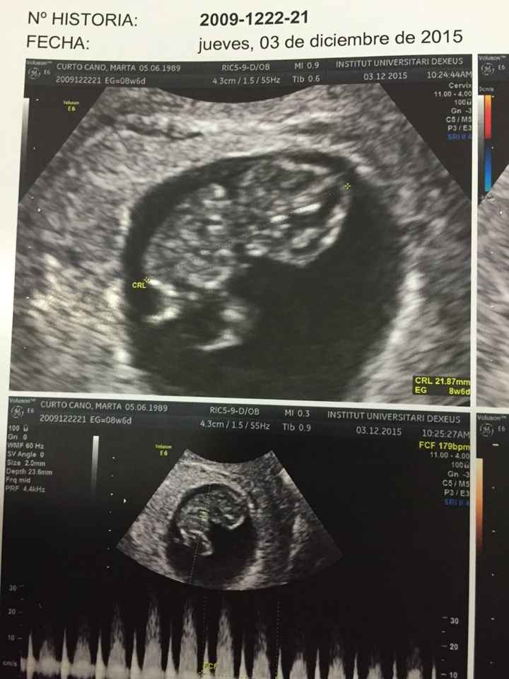 Futuras mamas julio 2016 - 1