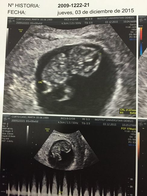 Futuras mamas julio 2016 - 1