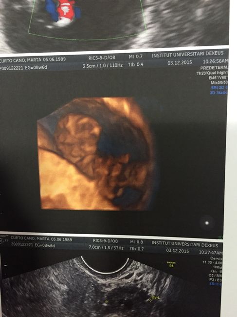 Futuras mamas julio 2016 - 2