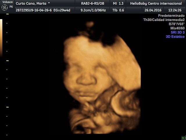 Futuras mamas julio 2016 - 2