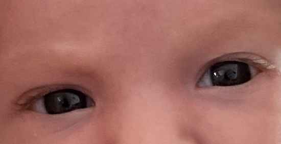 Color de ojos Recién Nacido - 2