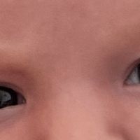 Color de ojos Recién Nacido - 2