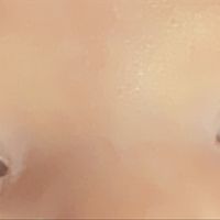 Color de ojos Recién Nacido - 3
