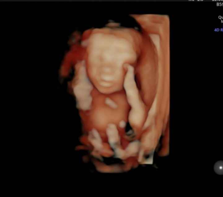 Futuras mamás Octubre 2018!!! - 1
