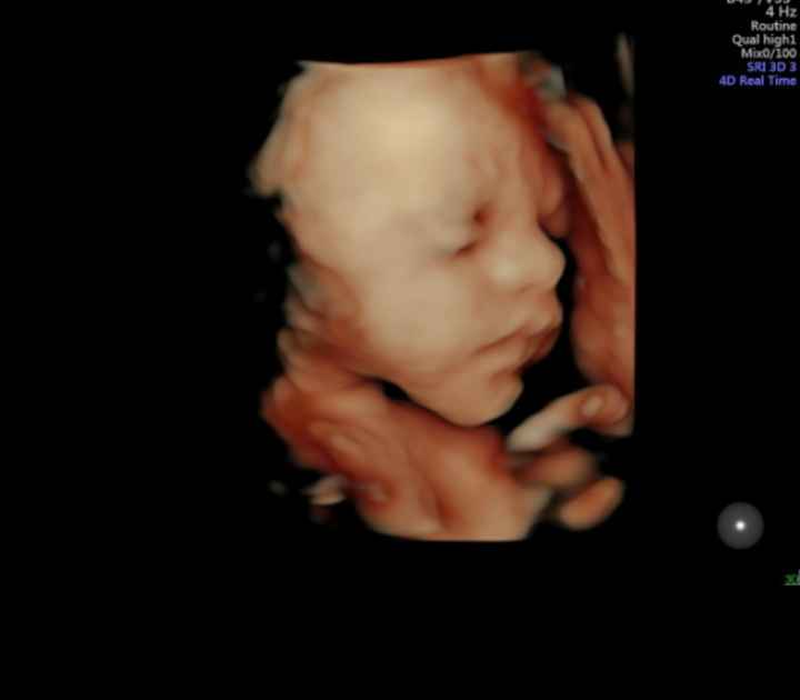 Futuras mamás Octubre 2018!!! - 1