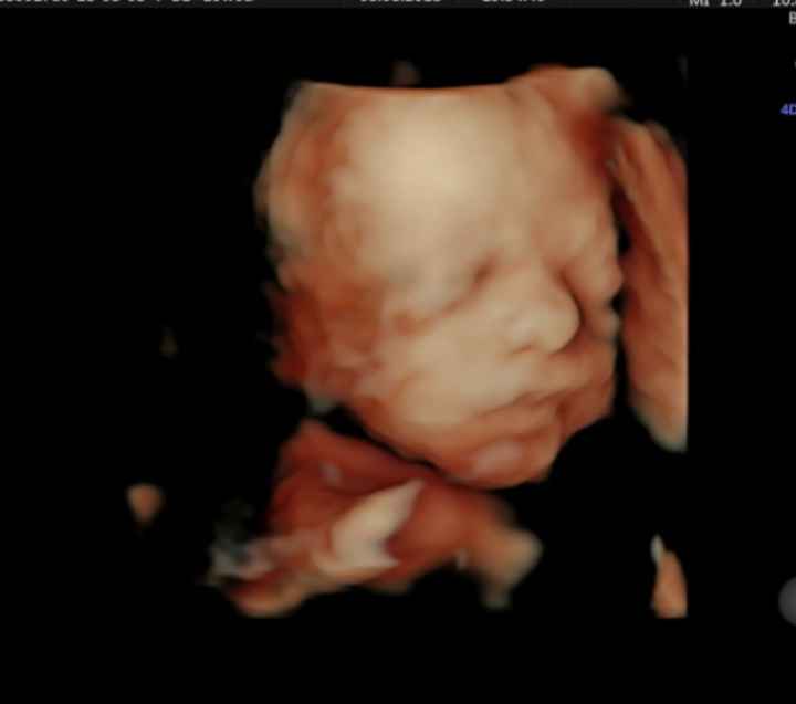 Futuras mamás Octubre 2018!!! - 2