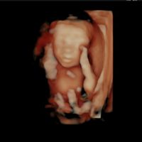 Futuras mamás Octubre 2018!!! - 1