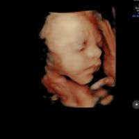Futuras mamás Octubre 2018!!! - 1