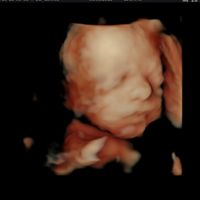 Futuras mamás Octubre 2018!!! - 2