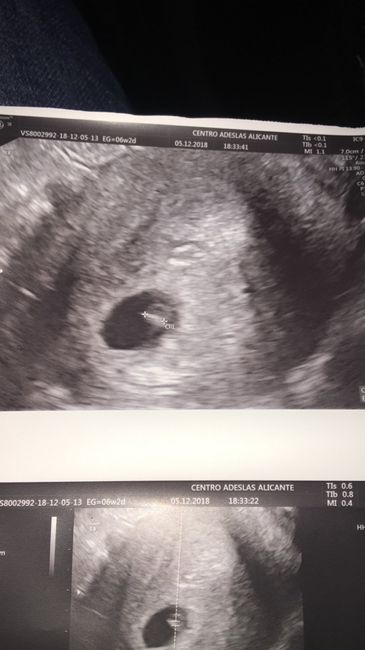 Futuras mamas julio 2019 - 1