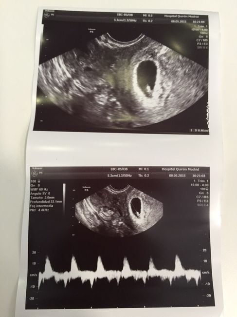 Mamis enero 2016 - 1