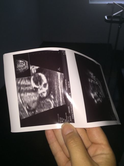 Mamis enero 2016 - 2