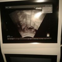 culito de lucia